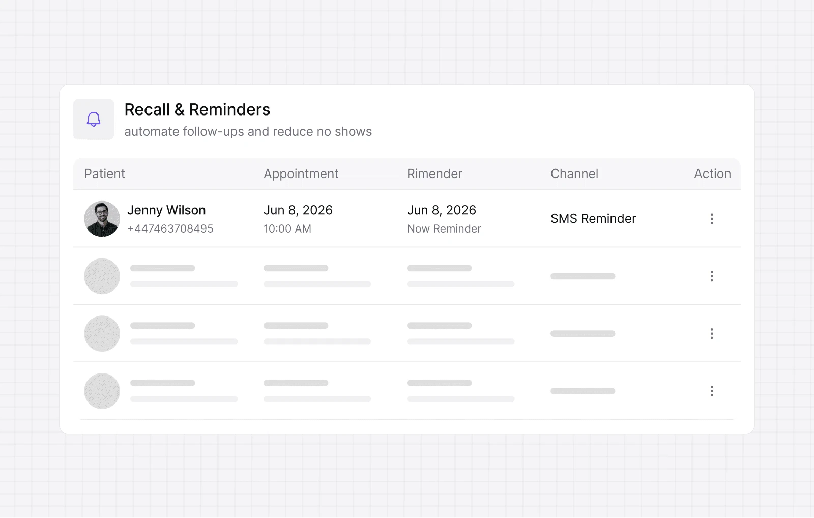 Dialbird appointment reminders showing scheduled dental recalls, reminder dates, and SMS follow-ups for patients.