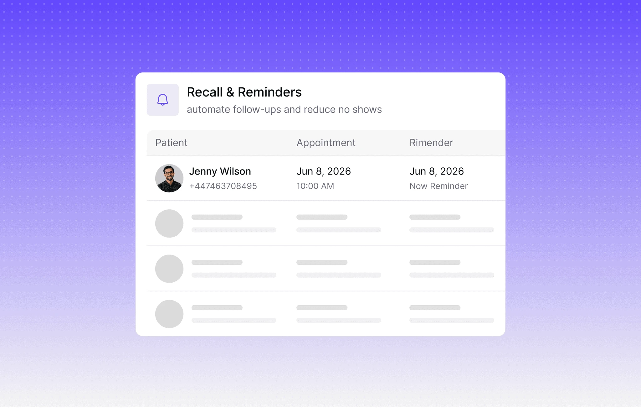 Dialbird viewing reminders showing scheduled property appointments and follow-up reminders for prospective buyers.